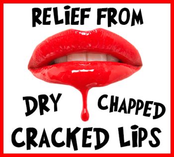 Henderson dentist, Dr. Hahn at Stephen P. Hahn DDS, tells you how to relieve your dry, chapped, and cracked lips!